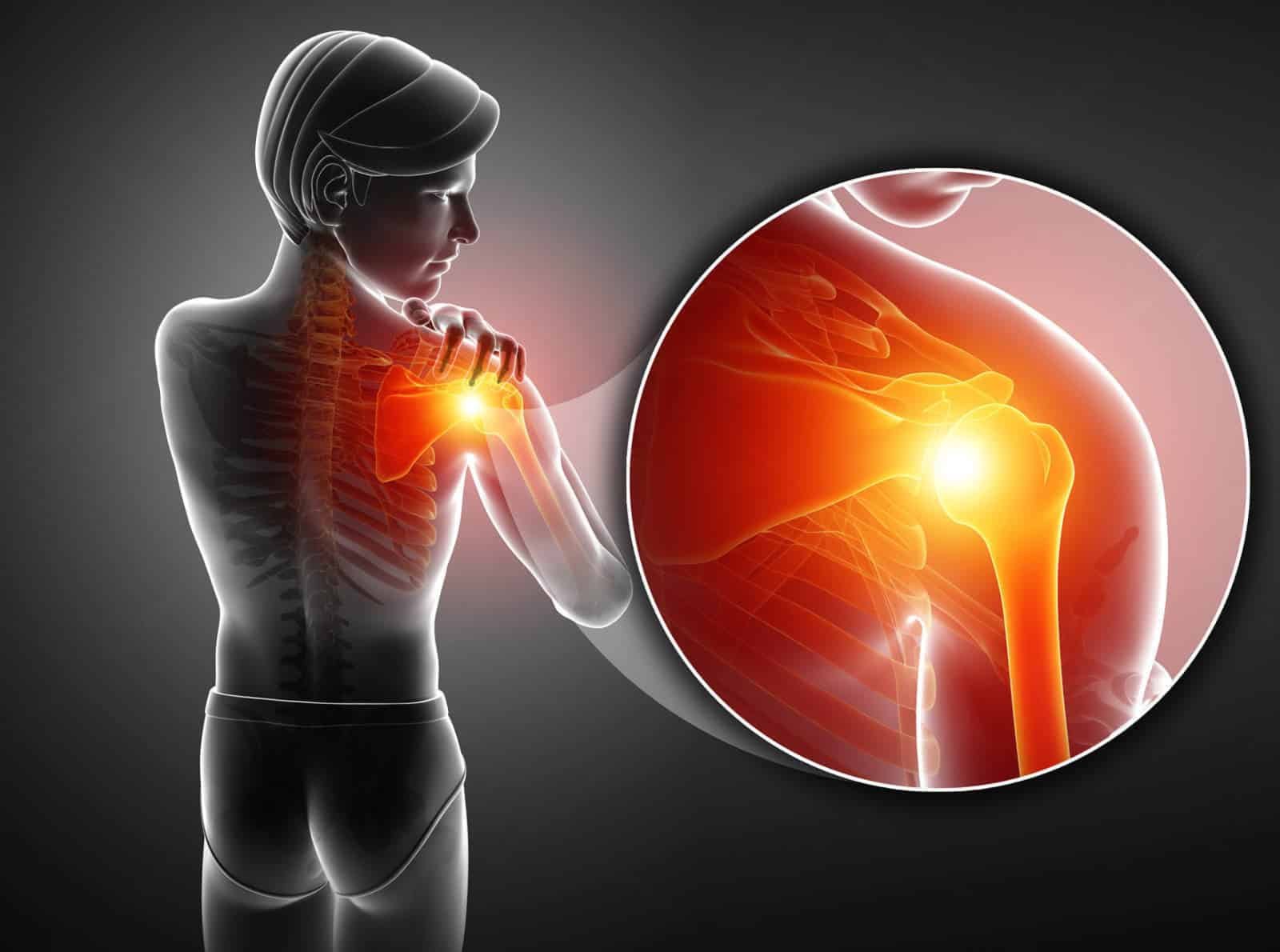 wmremove-transformed (1)